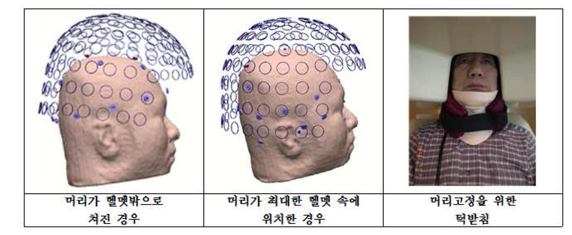 정확한 뇌자도 측정을 위해 본 원에서 개발한 환자의 신체적 특성을 고려한 헬멧 위치 조정방법 및 턱고정 장치 결과.