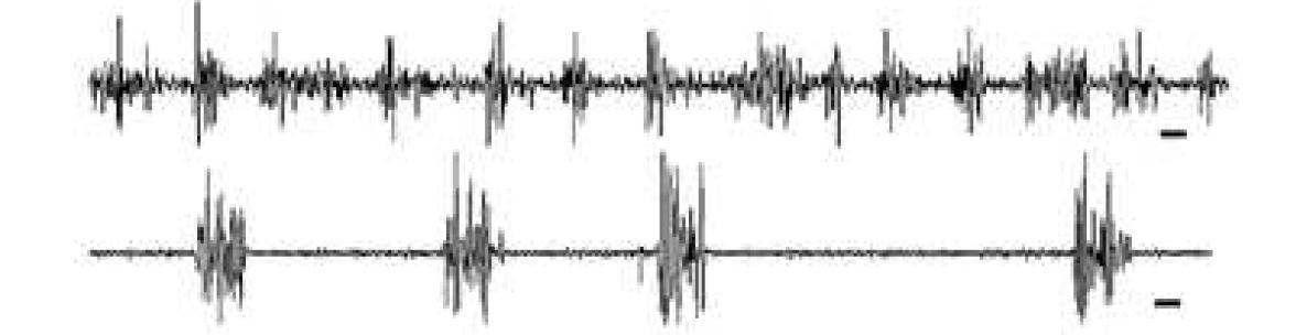 FeCl3 주입 chronic epilepsy mouse로 local field potential(LFP)을 측정하여spontaneous seizure파를 확인한 후, 그에 따른 실시간 광학 이미징을 진행함 (scale bar : 1 sec)난치성 간질 모델에서 local field potential을 통한 spontaneous seizure 확인 및 실시간 광학 이미징을 이용한 hemodynamics 측정