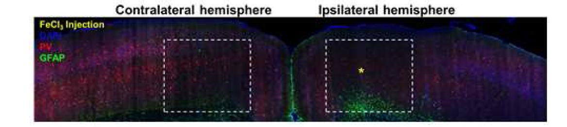난치성 간질 마우스 모델의 좌우 대뇌 반구에서 억제성 신경세포의 한 종류인 parvalbumin 을 발현하는 GABAergic interneuron을 염색한 결과(red), contralateral side에 비하여 FeCl3 용액 을 주입한 ipsilateral side의 대뇌 피질에서만 해당 GABAergic interneuron이 국소적으로 감소함. GFAP (green) 염색을 통해 교질 세포의 한 종류인 astrocyte의 발현 양상을 본 결과 (green), FeCl3 용액을 주입한 ipsilateral side에서 astrocyte의 발현이 크게 증가함.