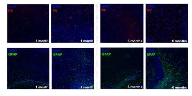 FeCl3 주입 후 1개월, 6개월의 경과 시기에 따라서 GABAergic interneuron과 astrocyte의 발현이 난치성 간질이 발달됨에 따라 달라졌음을 보임.