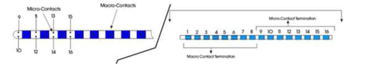 HFO를 기록하기 위한 Hybrid macro-micro depth 전극(왼쪽은 뇌에 삽입되는 전극이고, 오 른쪽은 connect cable임).