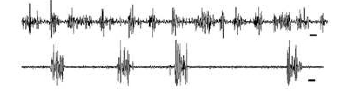 FeCl3 주입 chronic epilepsy mouse로 local field potential(LFP)을 측정하여spontaneous seizure파를 확인한 후, 그에 따른 실시간 광학 이미징을 진행함 (scale bar : 1 sec)