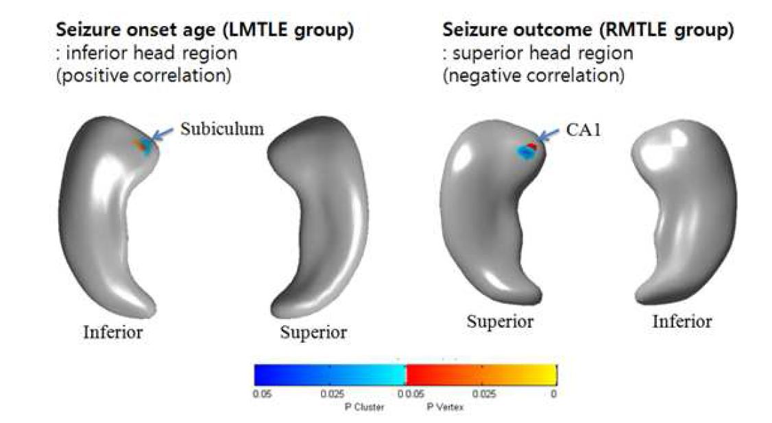 좌/우측두엽 간질 환자군에서의 해마 형태 변화와 임상 파라미터(seizure duration, onset age, seizure outcome)과의 상관관계 분석결과: