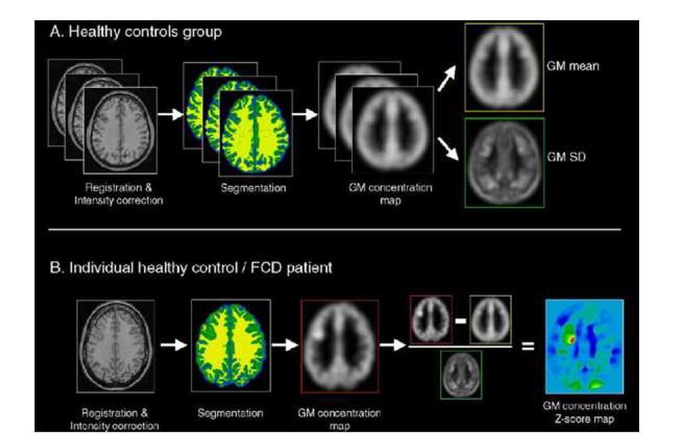 T1- weighted MRI데이터를 이용한 뇌회색질 자동검출 주요 처리과정