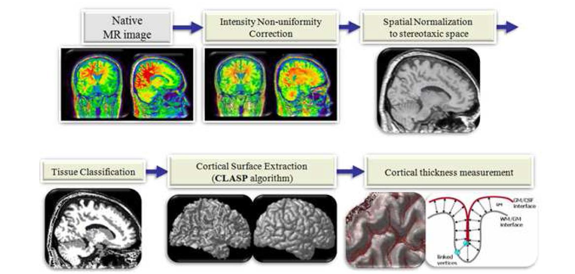 CLASP 알고리즘 기반의 CIVET 대뇌피질 두께 측정법의 주요 처리 과정