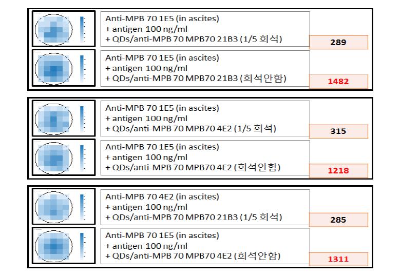 복수에 있는 MPB70 항체와 QDs/MPB70 항체복합체를 이용한 항원 100 ng/ml 농도 검출 결과