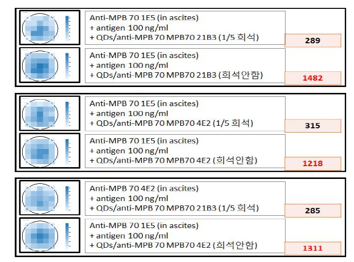 복수에 있는 MPB70 항체와 QDs/MPB70 항체복합체를 이용한 항원 100 ng/ml 농도 검출 결과