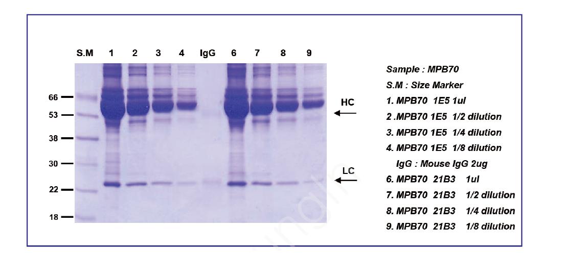 복수에서 생산된 IE5와 21B3 클론 항체의 SDS-PAGE 분석