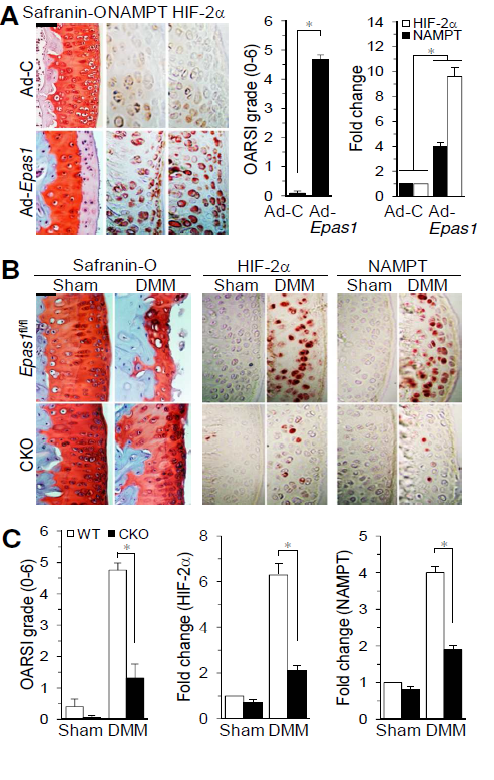 NAMPT expression in OA cartilage is regulated by HIF-2α.