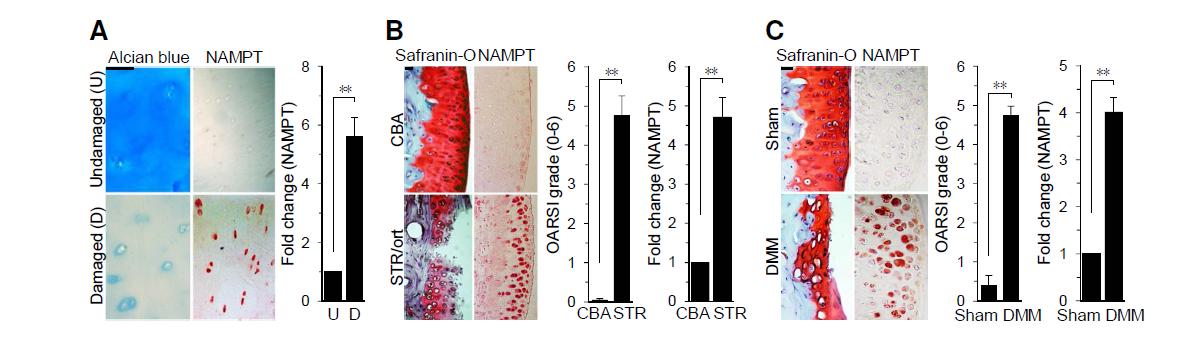 NAMPT is overexpressed in human and mouse OA chondrocytes.