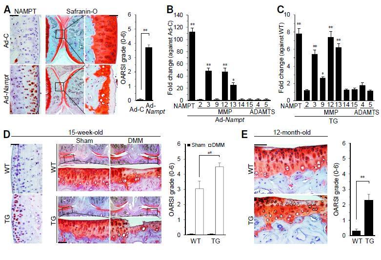 Overexpression of NAMPT in chondrocytes causes OA cartilage destruction.