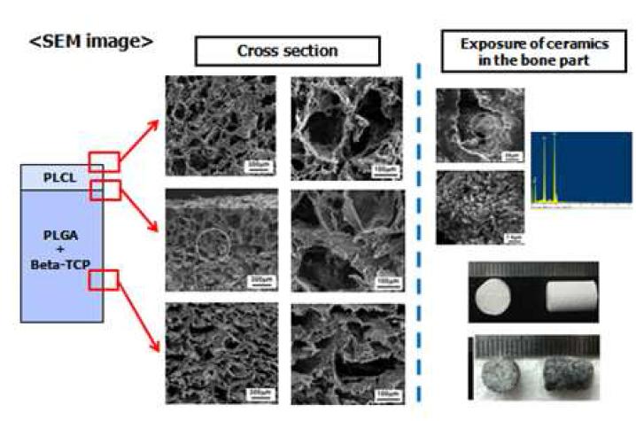 골-연골 복합체의 SEM 이미지 및 세라믹 염색사진