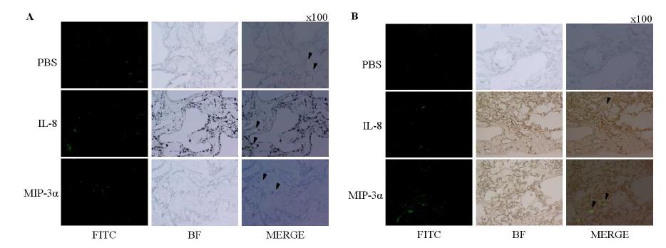 이식된 지지체 내부에 유입된 CD11b+ (A) 및 CD45+ (B) 면역세포의 면역형광염색결과