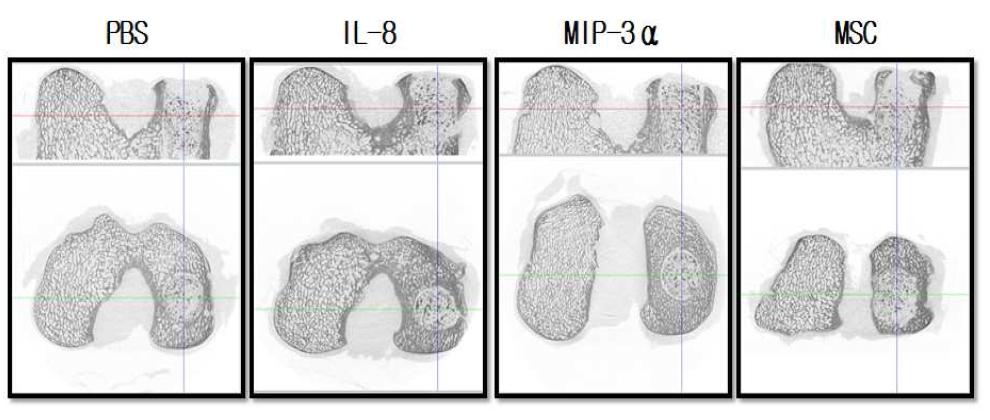 Micro CT 촬영에 의한 골밀도 검사