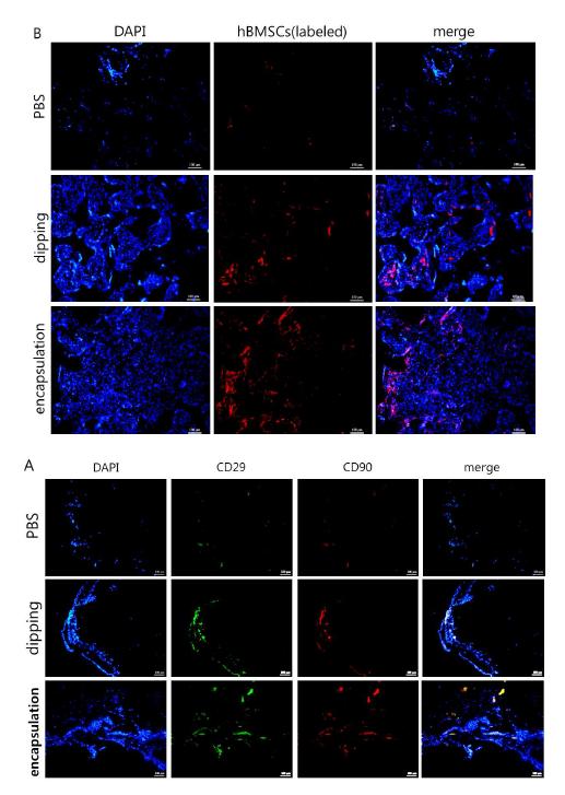 식된 지지체에 유도된 중간엽줄기세포(A:non-labeled hBMSCs, B:NIR-labeled hBMSCs)