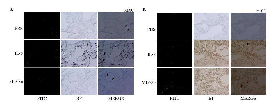 이식된 지지체 내부에 유입된 CD11b+ (A) 및 CD45+ (B) 면역세포의 면역형광염색결과