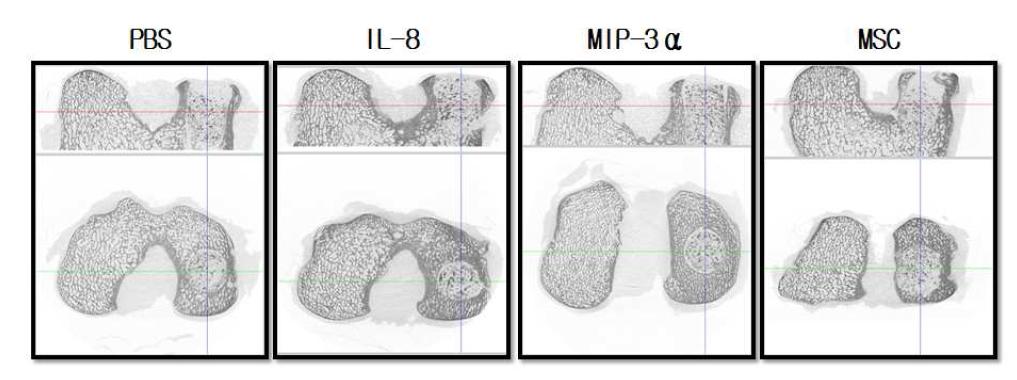 Micro CT 촬영에 의한 골밀도 검사