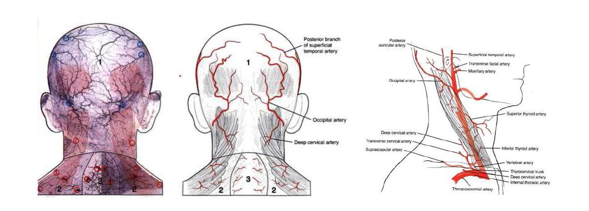 Angiogram of posterior aspect of H&N