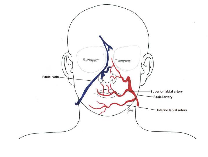 Distribution of facial artery and facial vein in the lower face transplantation