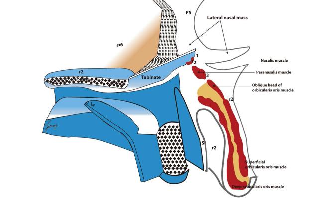 Schematic cross- sectional view of lateral nasal wall.