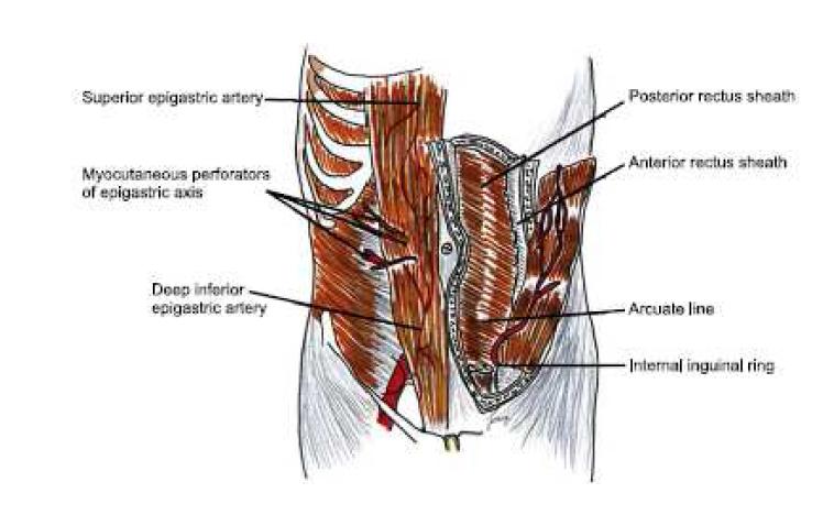 Schematic drawing of the rectus abdominis muscle and its arterial supply, showing deep inferior epigastric artery, posterior rectus sheath and arcuate line.