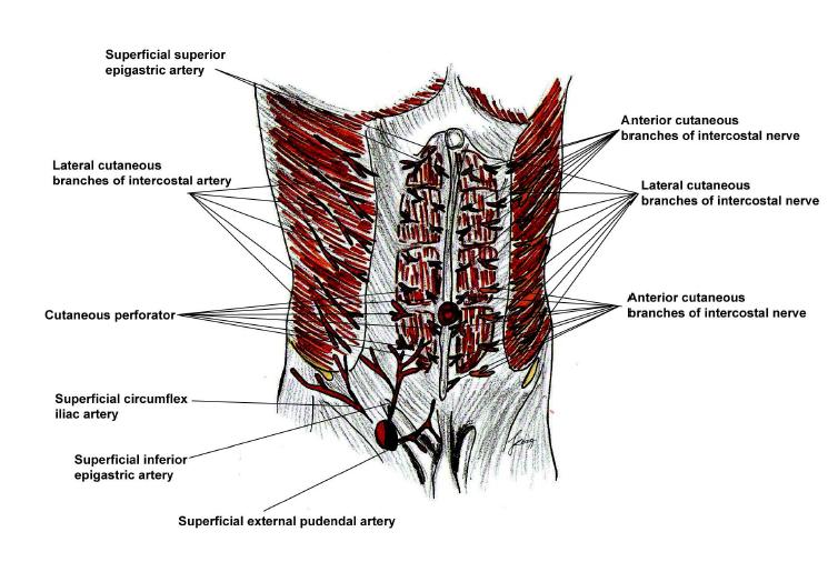 Schematic drawing of the cutaneous perforators of the deep inferior epigastric artery (right side), and the cutaneous nerve supplies of the intercostal nerve (left side).