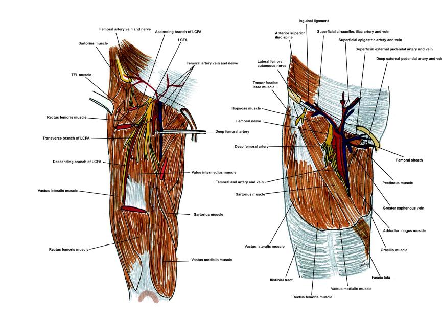 Schematic drawing of the femoral artery, descending branch of lateral circumflex femoral artery, and its related anatomies, anterior view. LCFA, lateral circumflex femoral artery; TFL, tensor fascia lata.