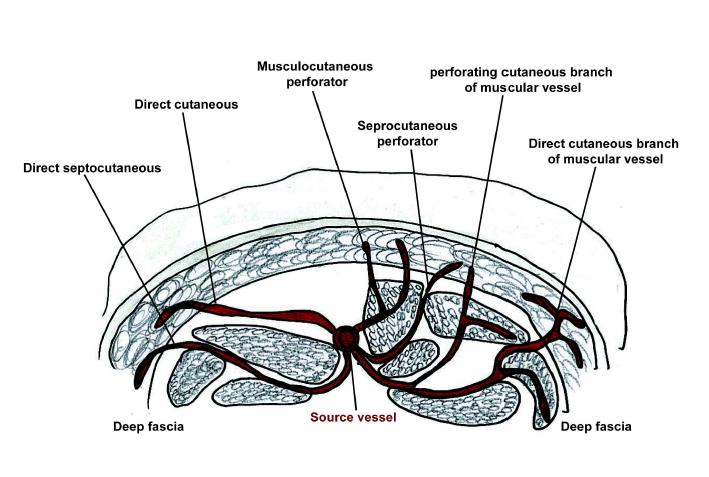 Representative schematic drawings of six distinctive deep fascia perforators