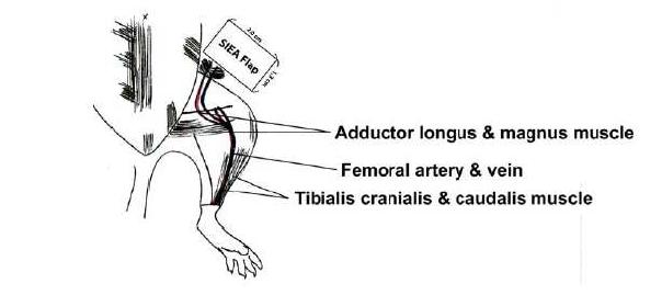 Schematic of the superficial inferior epigastric artery- based flap used in this study and project.