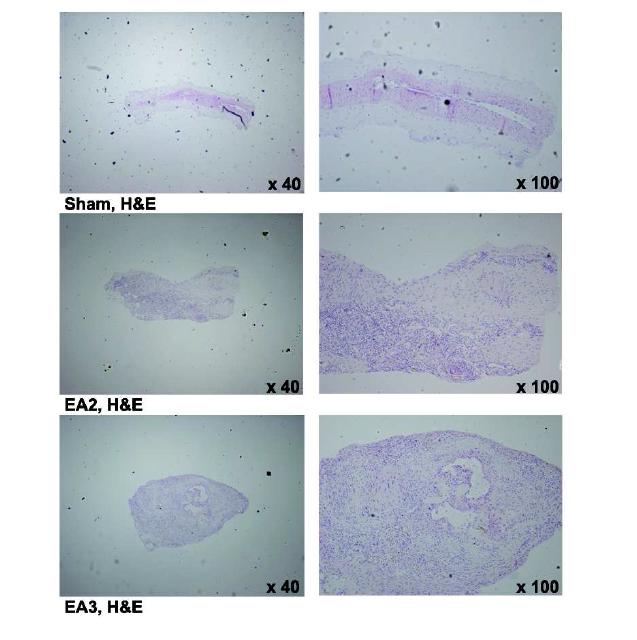 Photomicrographs shows longitudinal section of supermicroanastomosed SIEA with hematoxylin and eosin staining, in sham group (upper), in EA2 group (middle) and in EA3 group (lower).