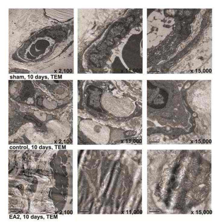 TEM findings comparisons between experimental groups.