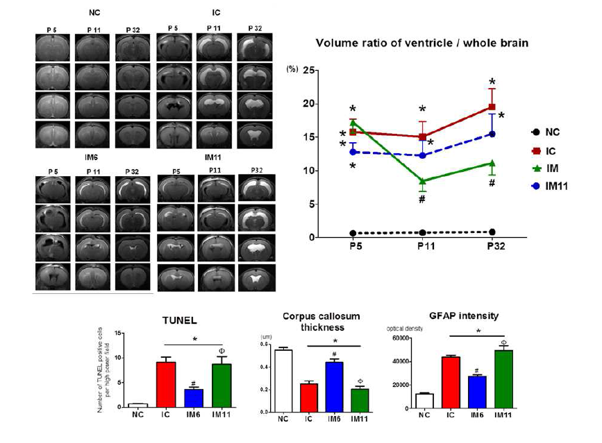 Early, not late, transplantation of MSCs attenuated PHH and brain injury after severe IVH in newborn rats.