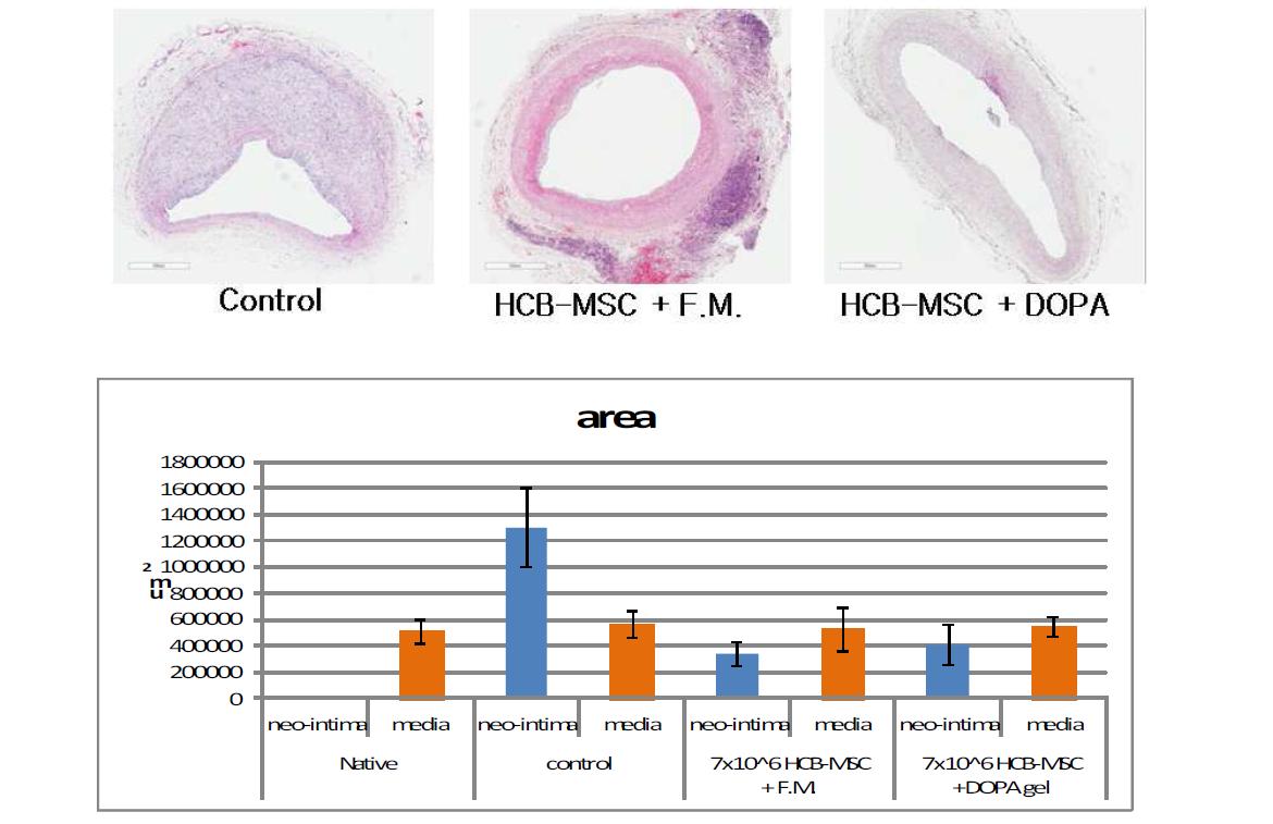 인간 제대혈 중간엽줄기세포의 neointima hyperplasia 억제 효과 확인