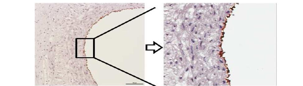 인간 제대혈 중간엽줄기세포 치료 7일째 reendotherlialization 확인