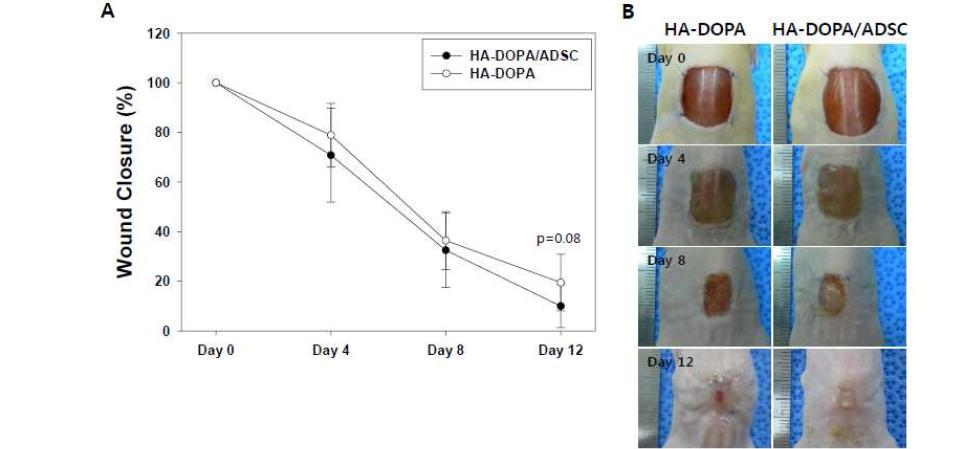 HA- DOPA 하이드로젤을 이용한 지방유래 줄기세포 이식. (A) 줄기세포 이식 후측정된 피부 결손조직 재생 효율. (B) 줄기세포 치료 후 피부 결손조직의 외형학적 변화.