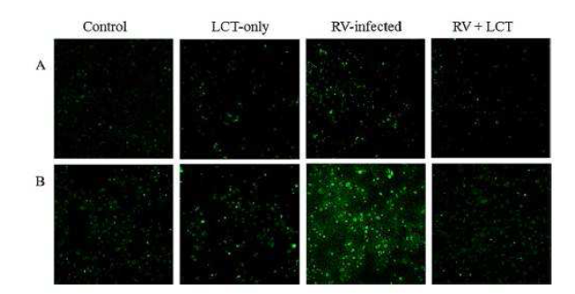 confocal immunofluorescence microscopy에 서 비강상피세포에 S. aureus(A)와 H. influenza(B)의 부착정도가 리노바이러스에 의해 각각 2.5, 2.7배 증가 되며 levocetirizine에 의해 각각 1.4, 1.4배로 감소되었 음.