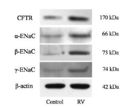 비강 상피세포에서 리노바이러스에 의 해 CFTR, α- ENaC, β- ENaC, γ- ENaC의 단백 질 발현이 각각 1.7, 1.9, 2.7, 1.4배로 유의하 게 증가하였음.