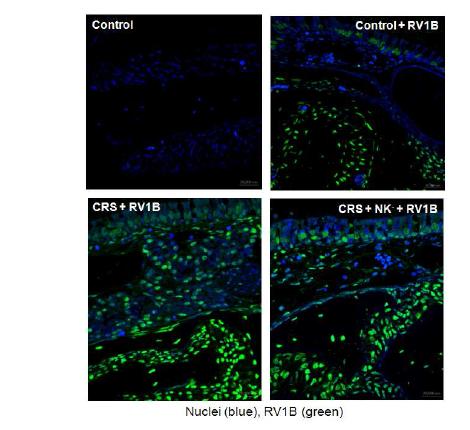 부비동 조직 내 RV 감염을 확인하기 위한 immunofluorescence microscopy 결과.