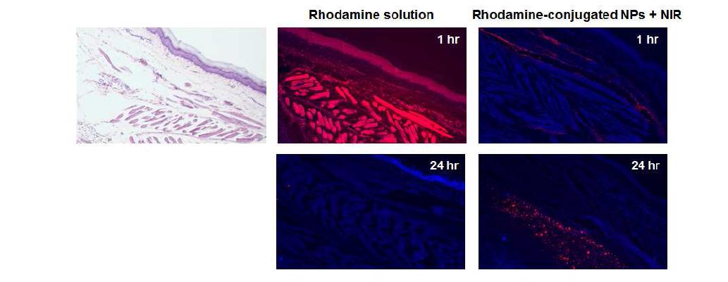 관절염 쥐에 rhodamine을 함유한 나노입자 주입 및 근적외선 적용