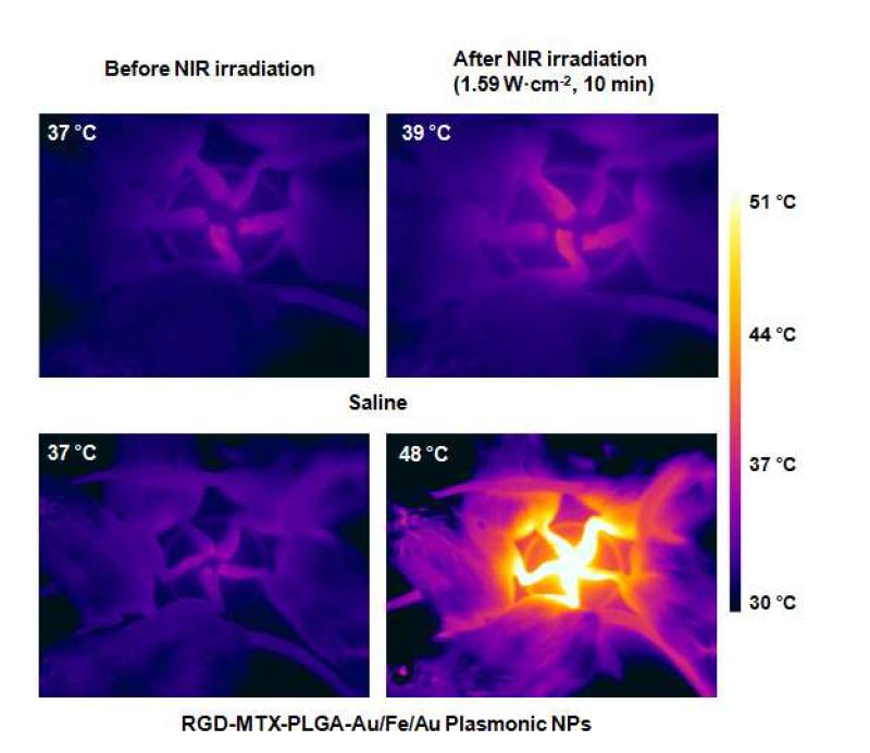 10분간 근적외선 조사에 따른 류마티스 관절염 부위의 온도 변화