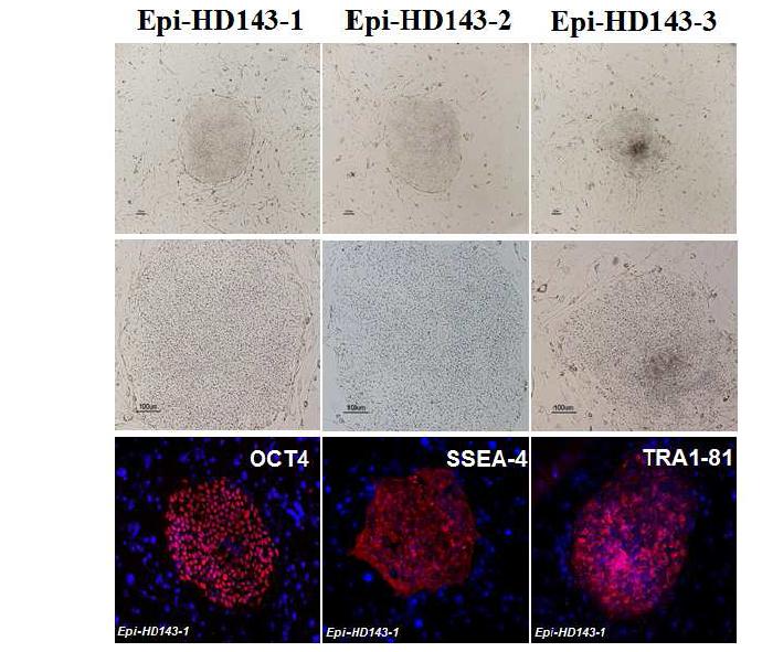 3종의 episomal iPSc 로부터 pluripotent marker인 Oct- 4, SSEA- 4, TRA1- 81 확인.