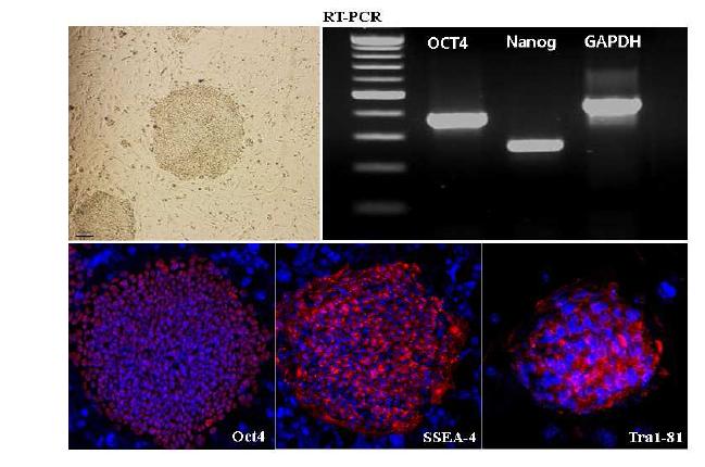 Pro- 1 iPSc 세포주 특성분석. 형태학적 특징 및 marker 발현 분석. Semi- quantitative RT- PCR 분석: Oct4 및 Nanog mRNA 발현이 높음을 나타내줌. 면역세포학적 분석: pluripotency marker인 OCT4, SSEA- 4, TRA- 1- 81이 발현됨을 나타내줌.