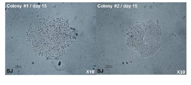 Sendai virus를 이용하여 제작된 인간말초혈액유래 유도만능줄기세포