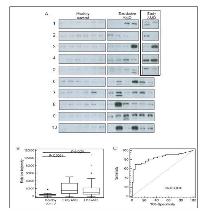 추가적인 vinculin의 western blot 검증