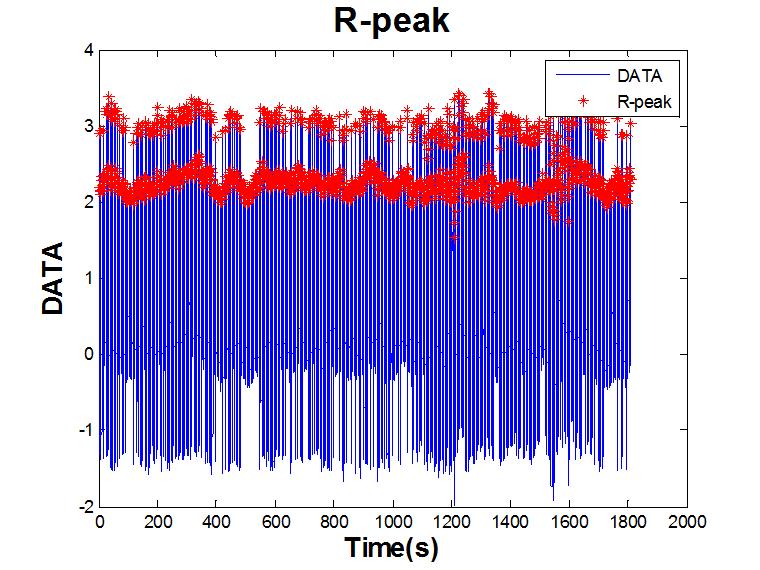 MIT-BIH 데이터베이스 신호를 통한 R-peak 검출 결과