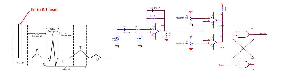 심박조율신호와 검출 모듈의 회로도