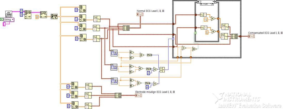 비정상 심전도 측정신호에서 정상 심전도를 복원하기 위한 알고리즘 개발환경