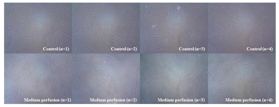 Morphology of alveolar bone marrow stem cells in a static culture (without perfusion) and a medium perfusion flow culture using the developed perfusion bioreactor system.