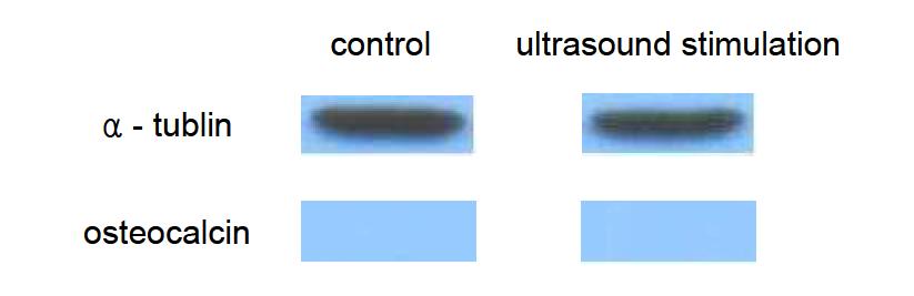 Western blot analysis of the proteins lysed from the transfected cells, with the α-tublin as the control.