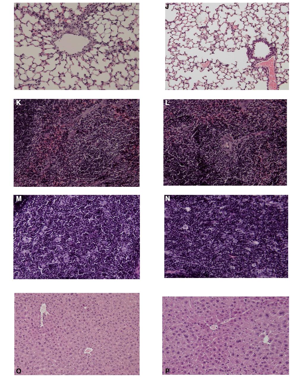 Photograph and light microscopic findings in the male C57BL/6 mice spleen, thymus,lung, liver, kidney, cerebrum, testis from three experimental diets and control groups.